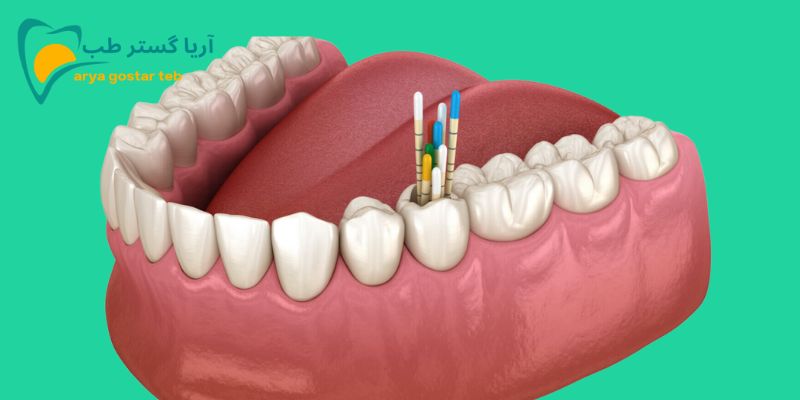 گوتا پرکا چیست؟